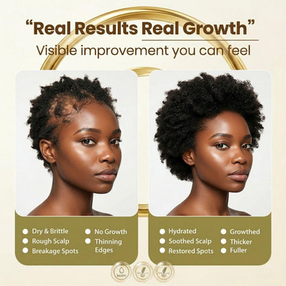 Hair Fertilizer® Advanced Hair Growth Serum - Hair Fertilizerhair growth serum